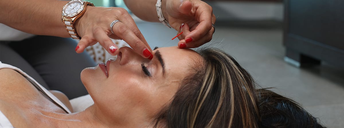 acupuncture